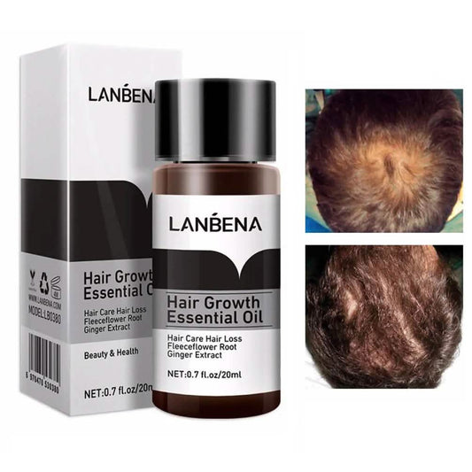 Essential Oil For Hair Growth And Hair Loss Treatment For Men And Women